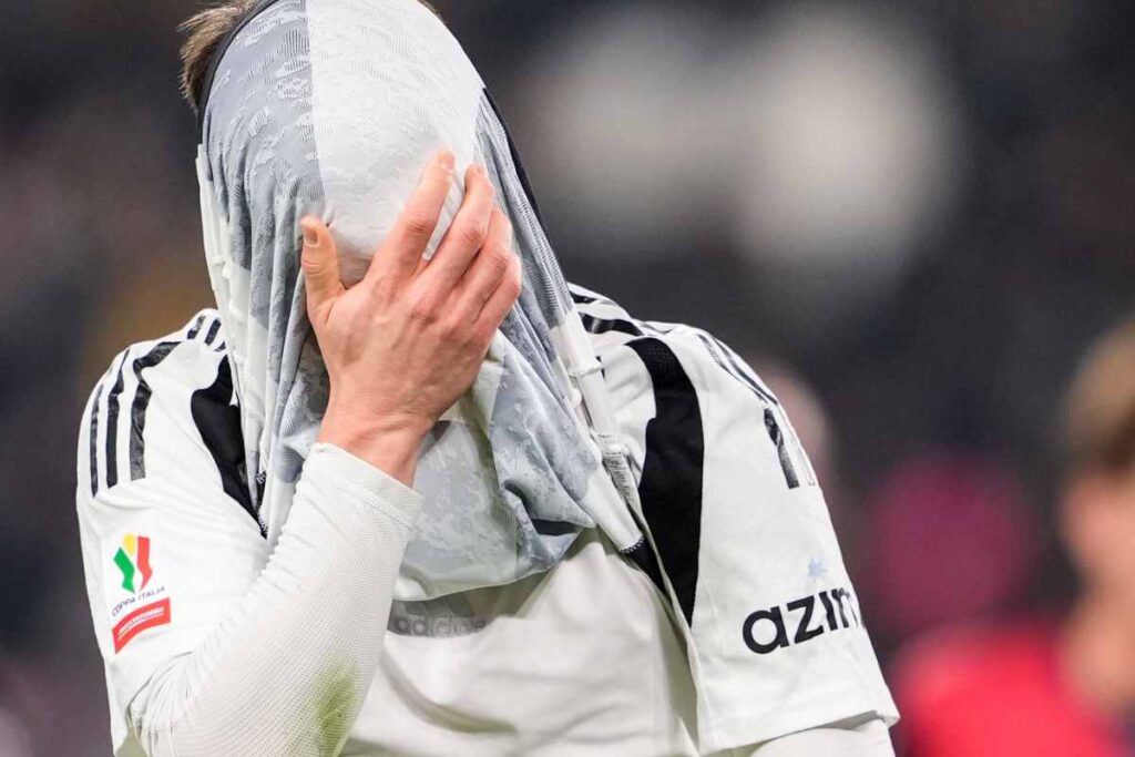 Giocatore Juve con la maglia in faccia